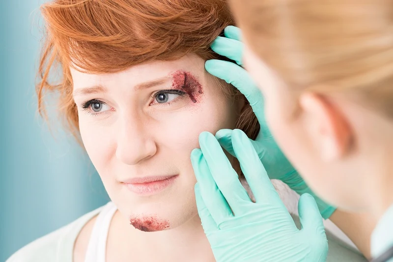 Mobile Urgent Wound Care in Los Angeles, CA