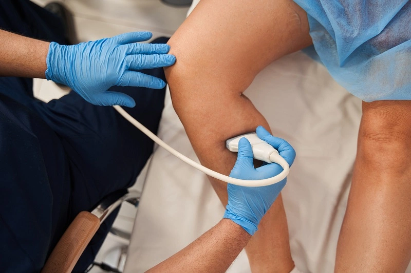 How Is Chronic Venous Insufficiency Diagnosed